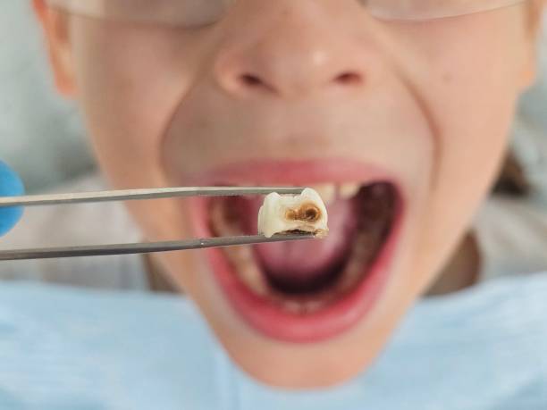Best Pediatric Emergency Dentist in Oroville, WA